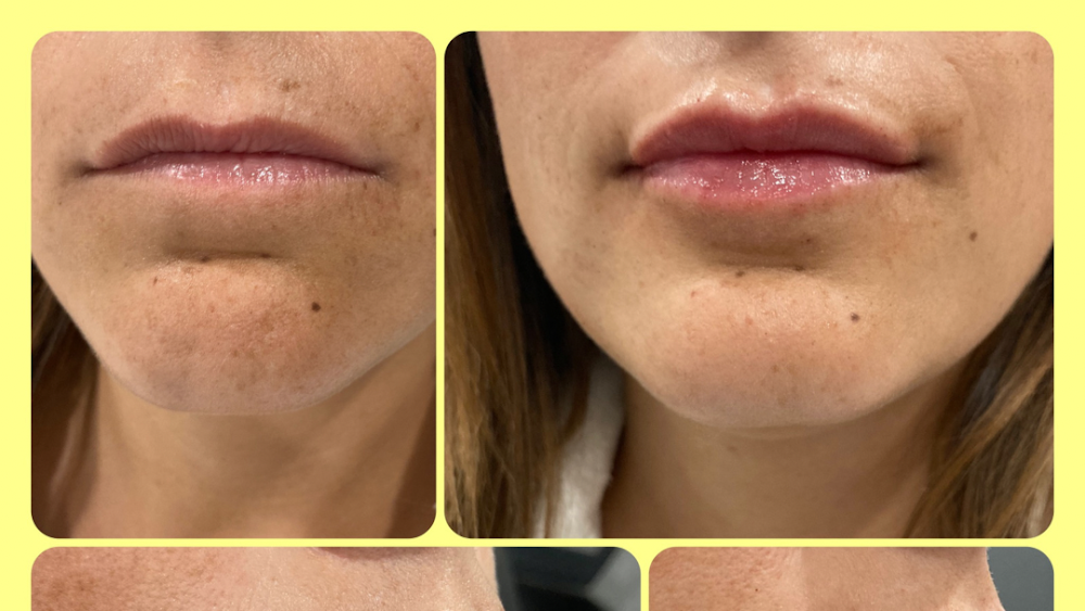 Face Value MedSpa